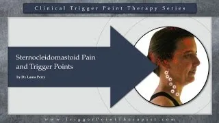 Sternocleidomastoid (SCM) Pain and Trigger Points