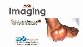 Soft tissue Tumors ( part 3) ..Prof.mamdouh Mahfouz (2019 edition)