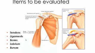 Imaging of Shoulder I  Erbil  May 2014 Dr Mamdouh Mahfouz In Arabic