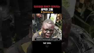 타이어와 피부가 합쳐지는 끔찍한 고통