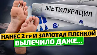 Вы ахнете узнав на что способна мазь Метилурацил!