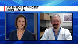 Ascension St. Vincent Opens New Burn Care Center