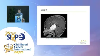 The landscape of Low Grade glioma