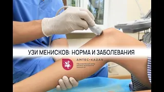 Узи менисков: норма и заболевания