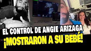 ANGIE Y JOTA COMPARTEN ECOGRAFIA EN TIEMPO REAL DE SU BEBÉ Y ASÍ REACCIONARON