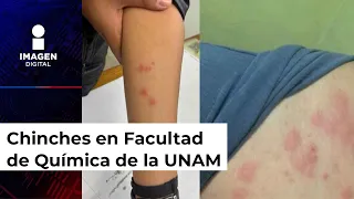 ¿Chinches en Facultad de Química de la UNAM se las llevaron del Metro CDMX?