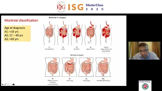 ISG MASTERCLASSI: (8) Management of Crohn's Disease