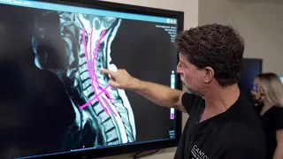 Symptoms of Cervical Stenosis | Jeffrey Cantor, MD