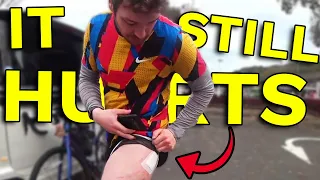 Connor Provides An Update On His Bike Injuries