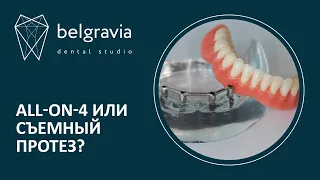 😬 Чем отличается протезирование all-on-4 от съемного протеза?