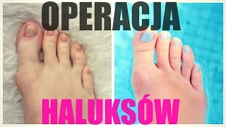 OPERACJA HALUKSÓW | VLOG