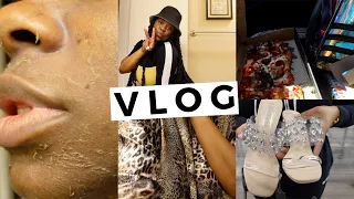 Weekly VLOG | Chemical Peel, Target Run, Throwing away makeup