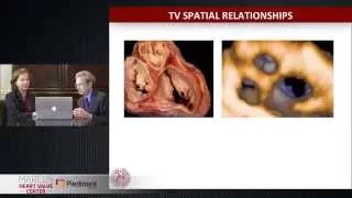 Echocardiographic Approach to the Tricuspid Valve: 3-D Echo 360 Conference