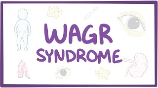 WAGR syndrome - causes, symptoms, diagnosis, treatment, pathology