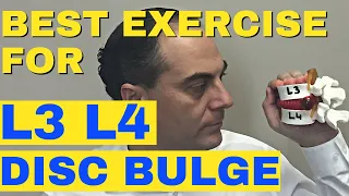 Best Exercise For L3-L4 Disc Bulge, L3-L4 Disc Herniation Dr Walter Salubro Chiropractor in Vaughan