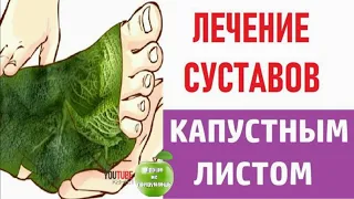 ЛЕЧЕНИЕ СУСТАВОВ КАПУСТНЫМ ЛИСТОМ