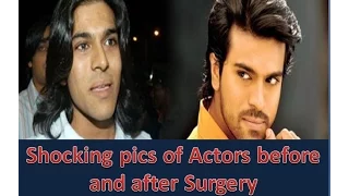 Shocking pictures of Top Film Actors before and after Surgery