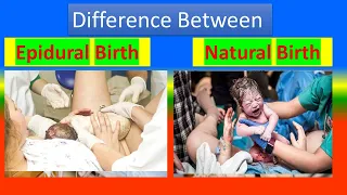 Difference between Epidural Birth and Natural Birth