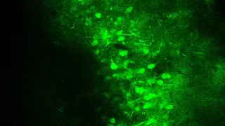 2-photon imaging of gustatory cortex