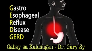 GastroEsophageal Reflux Disease (GERD) - Dr. Gary Sy