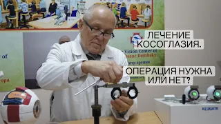 Лечение косоглазия. Операция нужна или нет?