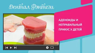 👃 Аденоиды и неправильный прикус у детей