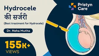 हाइड्रोसील की सर्जरी | Treatments For Hydrocele