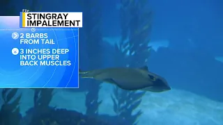 Woman speaks out after being 'impaled' by stingray in Florida