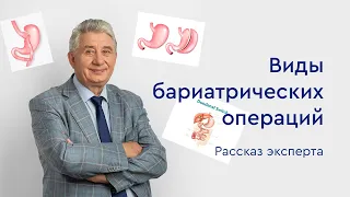 Виды бариатрических операций