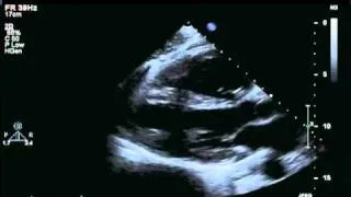 Echocardiographic Studies for Evaluation of Persistent Hypotension