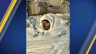 Mom says son badly burned after doing social media challenge
