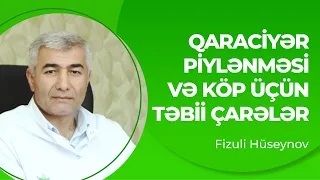 Qaraciyər piylənməsi və köp üçün təbii çarələr | Qaraciyər piylənməsinin müalicəsi | Fizuli Hüseynov