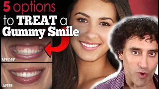 5 OPTIONS TO TREAT A GUMMY SMILE - Doctor's Advice