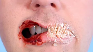 LIPS SUPER GLUED CLOSED!