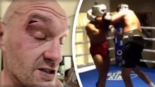 [LEAKED VIDEO]  Tyson Fury CUT IN SPARRING! Usyk Fight CANCELLED!