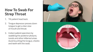 How to Swab for Strep Throat
