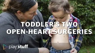 Half a heart: Toddler has life-changing open-heart surgery - twice | Stuff.co.nz