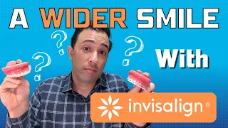 Can Invisalign Widen Your Smile As Well As Braces?