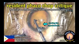 CataractCoach 1031: resident phaco chop critique