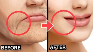 8mins!! Anti-Aging Face Exercise to Reduce Marionette Lines, Lift Droopy Mouth Corners, Sagging Jowl