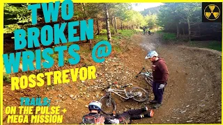 Rostrevor Two Broken Wrists and a bunch of jumps #MTB