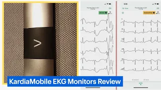 KardiaMobile Personal EKG Monitors Review