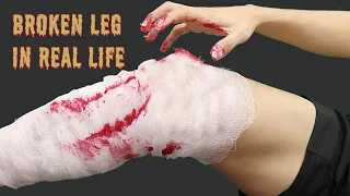 Stop Motion Cooking - Making Chiken Bake from Broken Leg | Mukbang asmr