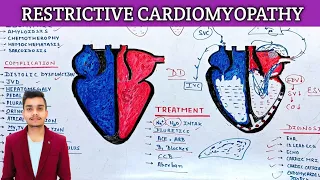 Restrictive Cardiomyopathy | Pathophysiology | and diagnosis