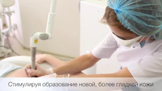 Лазерное лечение растяжек в NEO-Clinic