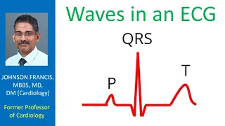 Waves in an ECG
