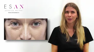 Los mejores tratamientos estéticos para eliminar las ojeras