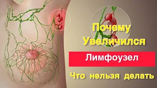 Почему увеличился лимфоузел. Что делать нельзя 🚫