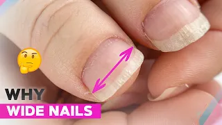 Wide Nails on the Thumbs | Gel Nail Correction | Soft Floral Nail Art