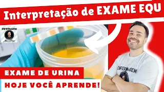 EQU - Como realizar a Interpretação do EXAME de URINA - Enfermagem Nua e Crua